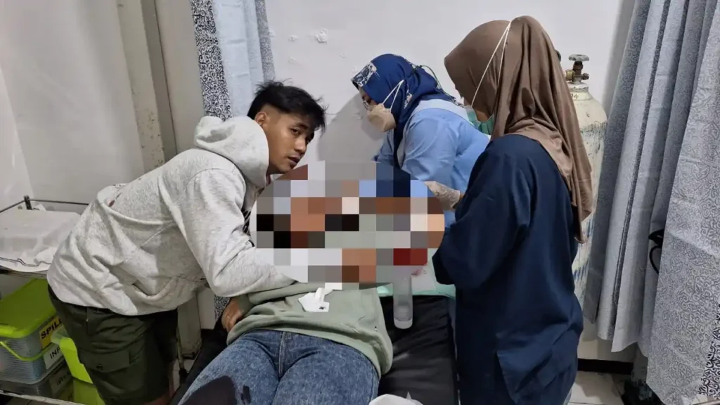 Aksi Begal Berdarah di Sawojajar, 2 Motor Dihadang Korban Luka Bacok