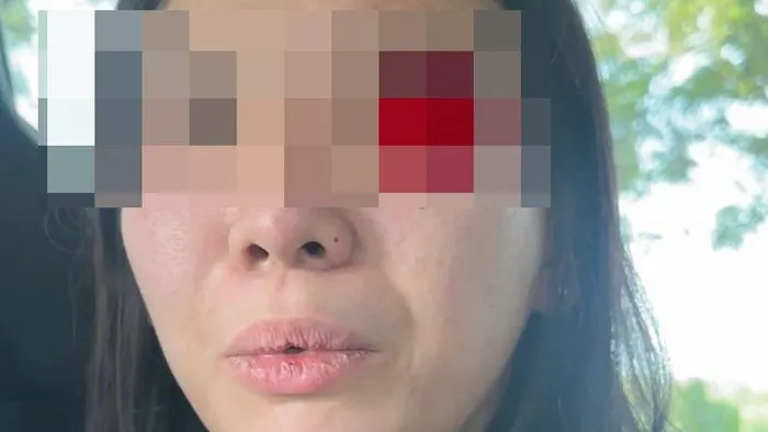 Pelaku Aniaya Anak Selebgram Malang Aghnia Punjabi Berhasil Ditangkap Polisi